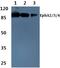 EPH Receptor A2 antibody, A00578T587, Boster Biological Technology, Western Blot image 