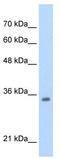 Transcription Factor 4 antibody, TA330066, Origene, Western Blot image 