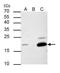 p21 antibody, NBP2-43697, Novus Biologicals, Immunoprecipitation image 