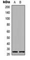 KDEL Endoplasmic Reticulum Protein Retention Receptor 2 antibody, GTX55288, GeneTex, Western Blot image 