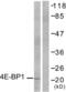 Eukaryotic Translation Initiation Factor 4E Binding Protein 1 antibody, LS-C118038, Lifespan Biosciences, Western Blot image 