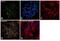 Ubiquinol-Cytochrome C Reductase Core Protein 2 antibody, PA5-30204, Invitrogen Antibodies, Immunofluorescence image 