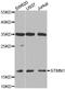 Stathmin 1 antibody, LS-C335216, Lifespan Biosciences, Western Blot image 