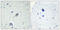 Cannabinoid Receptor 1 antibody, LS-C198818, Lifespan Biosciences, Immunohistochemistry paraffin image 