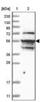 TNFAIP3 Interacting Protein 1 antibody, NBP2-32658, Novus Biologicals, Western Blot image 