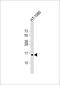 Tax1 Binding Protein 3 antibody, 61-233, ProSci, Western Blot image 