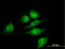 Methyltransferase Like 2B antibody, H00055798-B01P, Novus Biologicals, Immunofluorescence image 