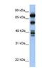 Spermatid Perinuclear RNA Binding Protein antibody, NBP1-57311, Novus Biologicals, Western Blot image 