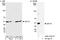 Eukaryotic Translation Elongation Factor 1 Gamma antibody, A300-734A, Bethyl Labs, Immunoprecipitation image 