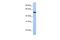 Solute Carrier Family 39 Member 5 antibody, PA5-42523, Invitrogen Antibodies, Western Blot image 