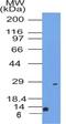 CD63 Molecule antibody, NBP2-36567, Novus Biologicals, Western Blot image 