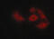 Claudin 5 antibody, GTX00796, GeneTex, Immunofluorescence image 