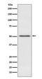 Ribosomal Oxygenase 2 antibody, M00783, Boster Biological Technology, Western Blot image 