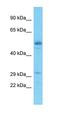 Exosome Component 3 antibody, orb324905, Biorbyt, Western Blot image 