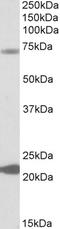 Potassium Calcium-Activated Channel Subfamily N Member 2 antibody, STJ72049, St John