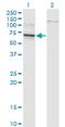 T-Box 22 antibody, H00050945-M01, Novus Biologicals, Western Blot image 