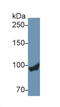 Glycogen Phosphorylase L antibody, LS-C372615, Lifespan Biosciences, Western Blot image 