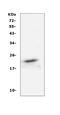 Fibroblast Growth Factor 21 antibody, PB10063, Boster Biological Technology, Western Blot image 