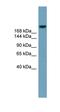 ATP Binding Cassette Subfamily A Member 12 antibody, orb330334, Biorbyt, Western Blot image 