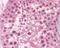 Dicer 1, Ribonuclease III antibody, NBP2-23891, Novus Biologicals, Immunohistochemistry paraffin image 