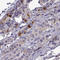 Collagen Type XXII Alpha 1 Chain antibody, HPA024830, Atlas Antibodies, Immunohistochemistry paraffin image 