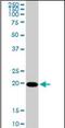 Cytidine/Uridine Monophosphate Kinase 1 antibody, orb95001, Biorbyt, Western Blot image 