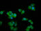 Myozenin 2 antibody, LS-C680912, Lifespan Biosciences, Immunofluorescence image 