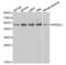 Killer Cell Immunoglobulin Like Receptor, Three Ig Domains And Long Cytoplasmic Tail 1 antibody, LS-C331588, Lifespan Biosciences, Western Blot image 