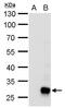 SET And MYND Domain Containing 3 antibody, PA5-31919, Invitrogen Antibodies, Western Blot image 