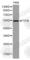 Phosphatase And Tensin Homolog antibody, A2113, ABclonal Technology, Western Blot image 