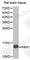 Hemoglobin Subunit Alpha 2 antibody, A1375, ABclonal Technology, Western Blot image 