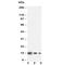 IL-4 antibody, R30494, NSJ Bioreagents, Western Blot image 