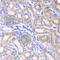 Aldehyde Dehydrogenase 1 Family Member A2 antibody, A7503, ABclonal Technology, Immunohistochemistry paraffin image 