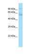 Serine/threonine-protein kinase PINK1, mitochondrial antibody, orb331223, Biorbyt, Western Blot image 