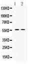 Angiopoietin-related protein 2 antibody, LS-C662238, Lifespan Biosciences, Western Blot image 