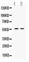 Angiopoietin Like 2 antibody, LS-C662238, Lifespan Biosciences, Western Blot image 