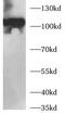 Roundabout Guidance Receptor 4 antibody, FNab10791, FineTest, Western Blot image 
