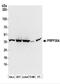 Pre-MRNA Processing Factor 38A antibody, NBP2-37697, Novus Biologicals, Western Blot image 