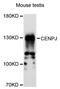 Centromere Protein J antibody, STJ113581, St John