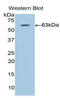 Adiponectin Receptor 1 antibody, LS-C418631, Lifespan Biosciences, Western Blot image 