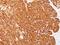 Melanoma Marker antibody, NBP2-48257, Novus Biologicals, Immunohistochemistry paraffin image 