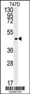 Proenkephalin-A antibody, 62-092, ProSci, Western Blot image 