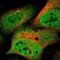 Valosin Containing Protein antibody, NBP1-81620, Novus Biologicals, Immunocytochemistry image 