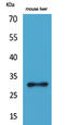 Fibroblast Growth Factor 5 antibody, STJ96555, St John