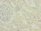 Interferon Induced Protein 44 antibody, LS-C395920, Lifespan Biosciences, Immunohistochemistry paraffin image 