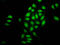 Nucleoporin 98 antibody, LS-C674962, Lifespan Biosciences, Immunofluorescence image 