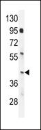 Interferon Regulatory Factor 9 antibody, 56-092, ProSci, Western Blot image 