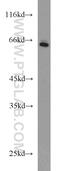 Myotubularin 1 antibody, 13924-1-AP, Proteintech Group, Western Blot image 