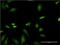 Farnesyltransferase, CAAX Box, Beta antibody, H00002342-M01, Novus Biologicals, Immunocytochemistry image 