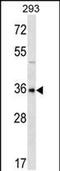 Gastrulation Brain Homeobox 1 antibody, PA5-48753, Invitrogen Antibodies, Western Blot image 